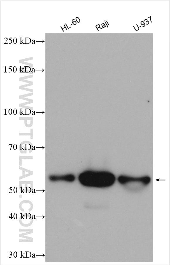 Western Blot (WB) analysis of various lysates using LSP1 Polyclonal antibody (15593-1-AP)