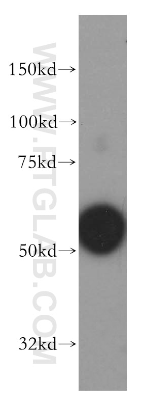 Western Blot (WB) analysis of U-937 cells using LSP1 Polyclonal antibody (15593-1-AP)