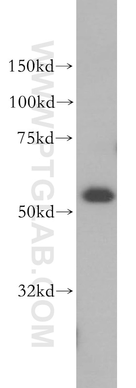 Western Blot (WB) analysis of Raji cells using LSP1 Polyclonal antibody (15593-1-AP)