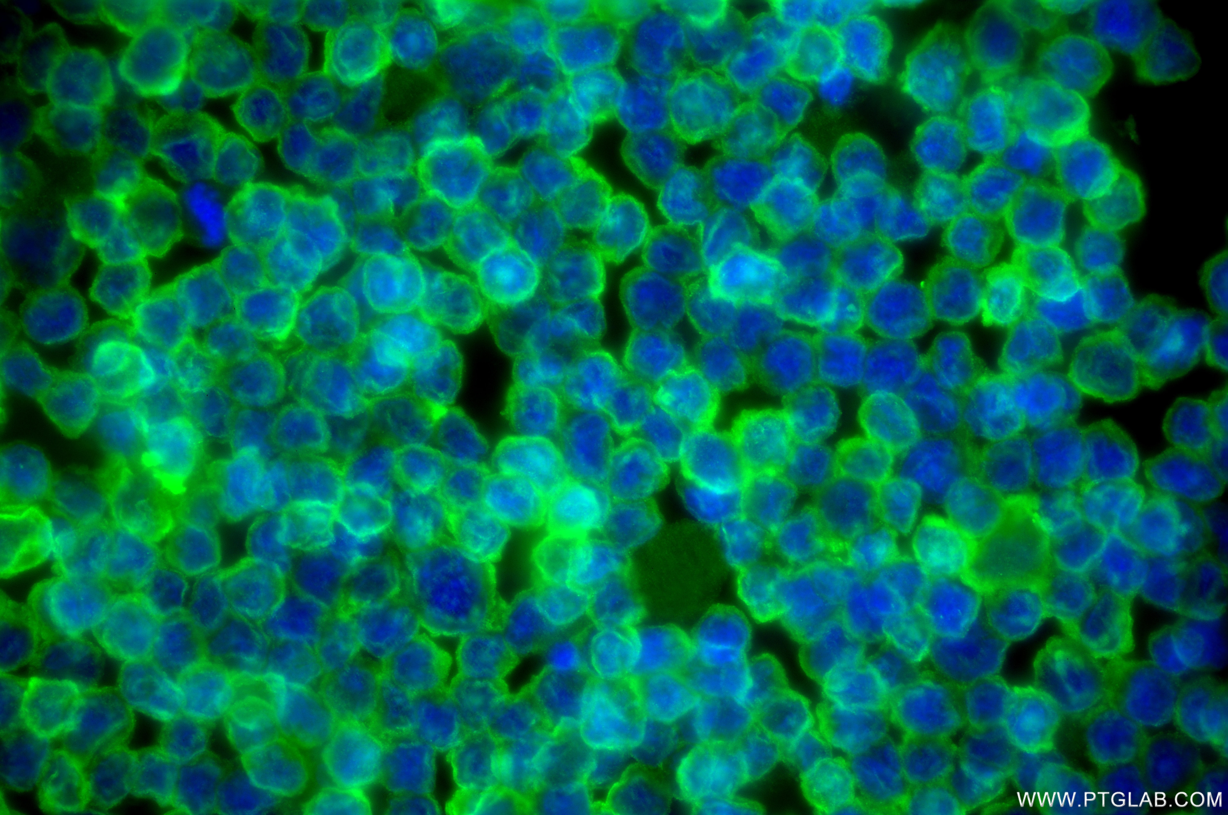 IF Staining of Daudi using 87378-1-RR Immunofluorescence (IF) / fluorescent staining of Daudi cells using LSP1 Recombinant monoclonal antibody (87378-1-RR)