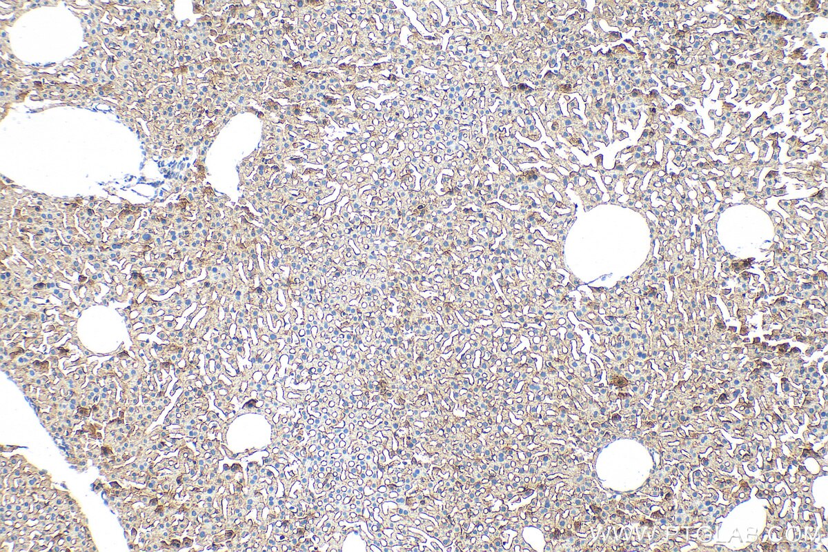 Immunohistochemistry (IHC) staining of mouse liver tissue using LSR Polyclonal antibody (18216-1-AP)