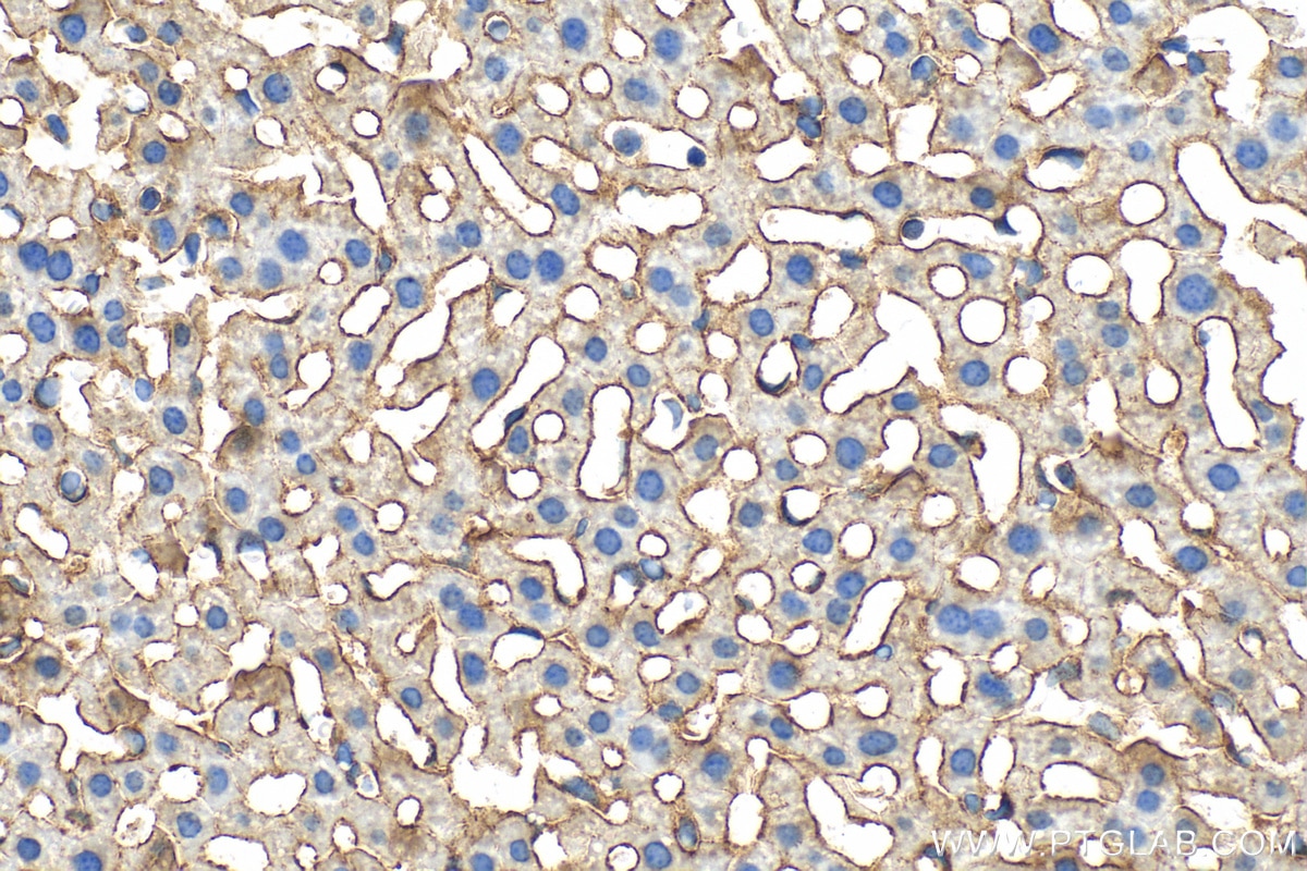 Immunohistochemistry (IHC) staining of mouse liver tissue using LSR Polyclonal antibody (18216-1-AP)