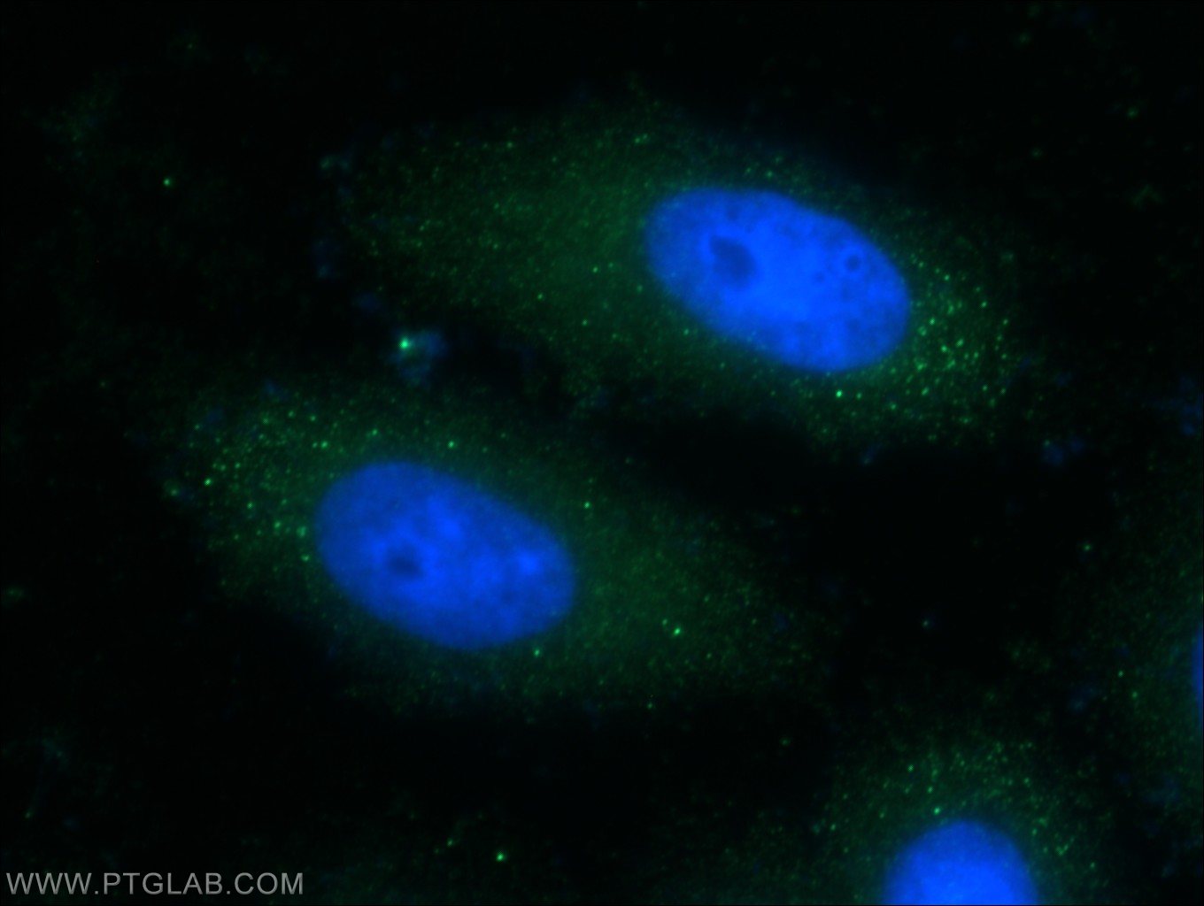 Immunofluorescence (IF) / fluorescent staining of HepG2 cells using LSS Polyclonal antibody (13715-1-AP)