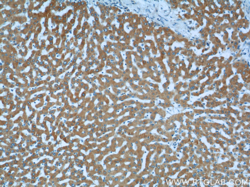 Immunohistochemistry (IHC) staining of human liver tissue using LSS Polyclonal antibody (13715-1-AP)