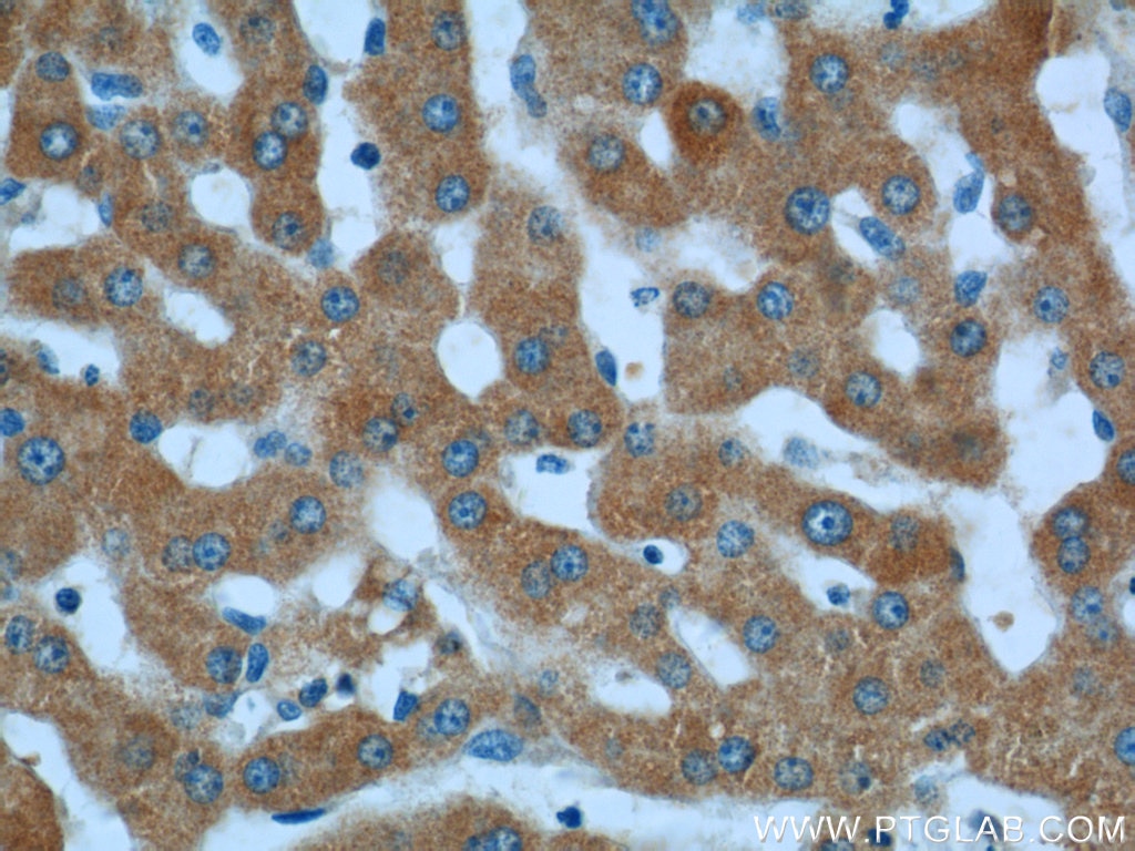 Immunohistochemistry (IHC) staining of human liver tissue using LSS Polyclonal antibody (13715-1-AP)