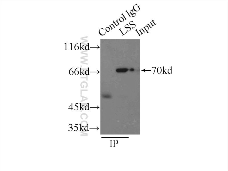 Immunoprecipitation (IP) experiment of HepG2 cells using LSS Polyclonal antibody (13715-1-AP)