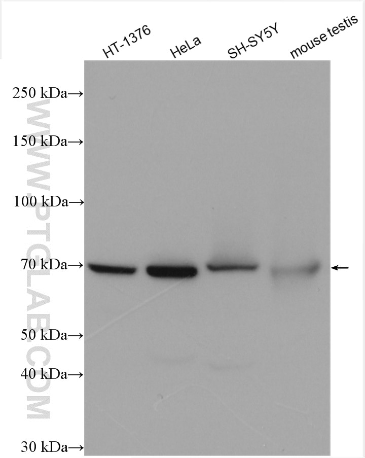 Western Blot (WB) analysis of various lysates using LSS Polyclonal antibody (13715-1-AP)