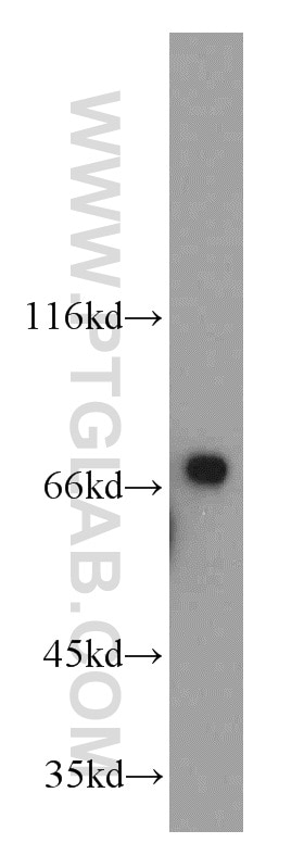 Western Blot (WB) analysis of HepG2 cells using LSS Polyclonal antibody (13715-1-AP)