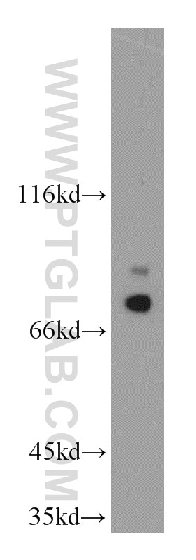 Western Blot (WB) analysis of mouse testis tissue using LSS Polyclonal antibody (13715-1-AP)