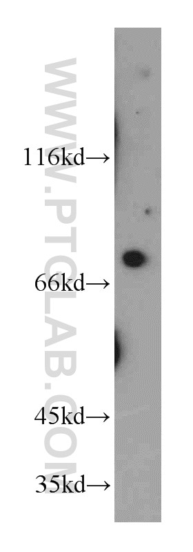 Western Blot (WB) analysis of human brain tissue using LSS Polyclonal antibody (13715-1-AP)