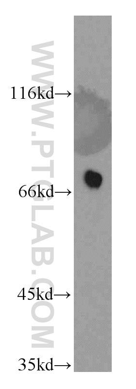 Western Blot (WB) analysis of mouse pancreas tissue using LSS Polyclonal antibody (13715-1-AP)