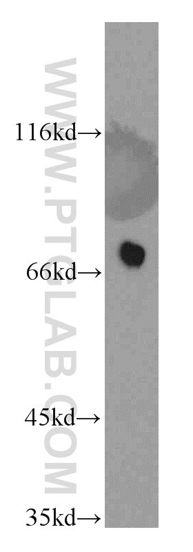 WB analysis of mouse pancreas using 13715-1-AP