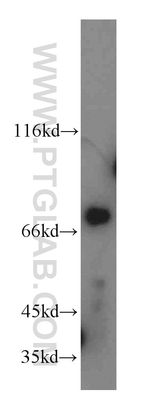 Western Blot (WB) analysis of HeLa cells using LSS Polyclonal antibody (13715-1-AP)