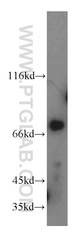 WB analysis of HeLa using 13715-1-AP