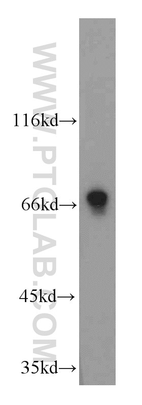 Western Blot (WB) analysis of mouse liver tissue using LSS Polyclonal antibody (13715-1-AP)