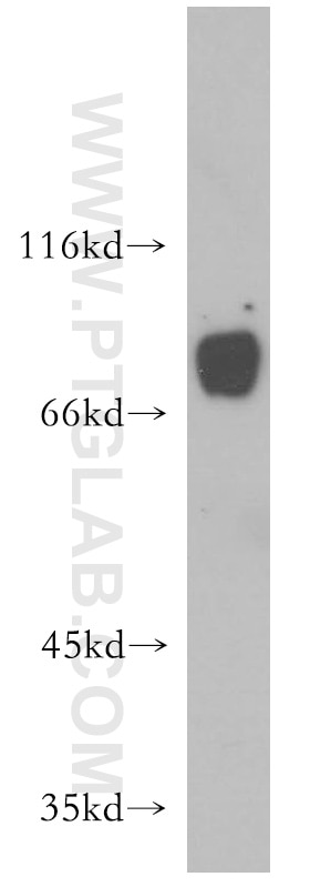 Western Blot (WB) analysis of PC-3 cells using LSS Polyclonal antibody (13715-1-AP)