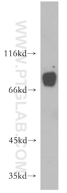 WB analysis of PC-3 using 13715-1-AP