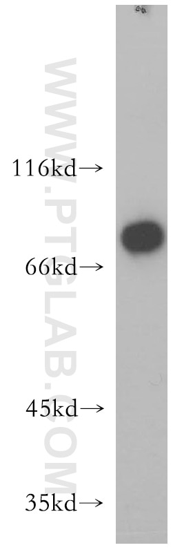 Western Blot (WB) analysis of HeLa cells using LSS Polyclonal antibody (13715-1-AP)