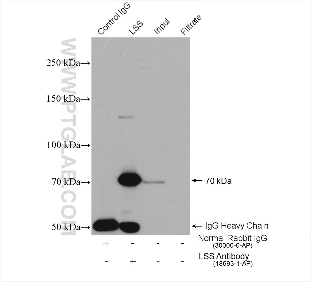 Immunoprecipitation (IP) experiment of HeLa cells using LSS Polyclonal antibody (18693-1-AP)