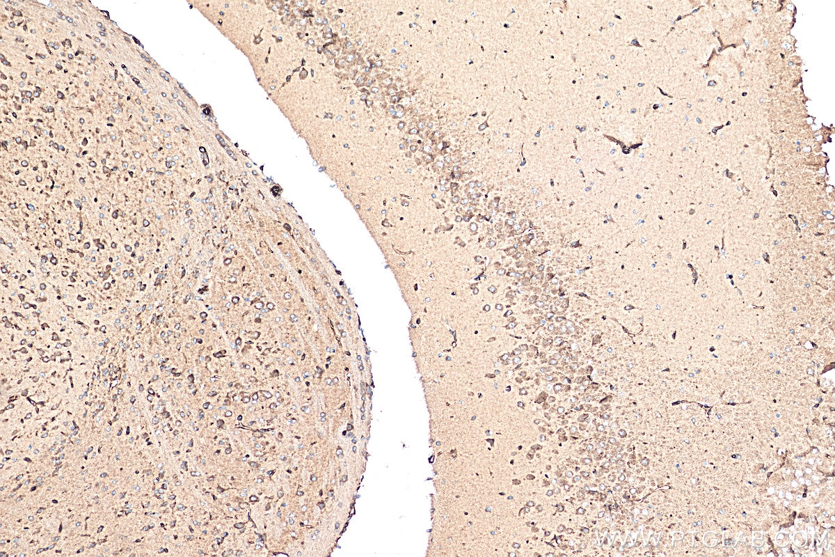 Immunohistochemistry (IHC) staining of mouse brain tissue using LST1 Polyclonal antibody (21361-1-AP)
