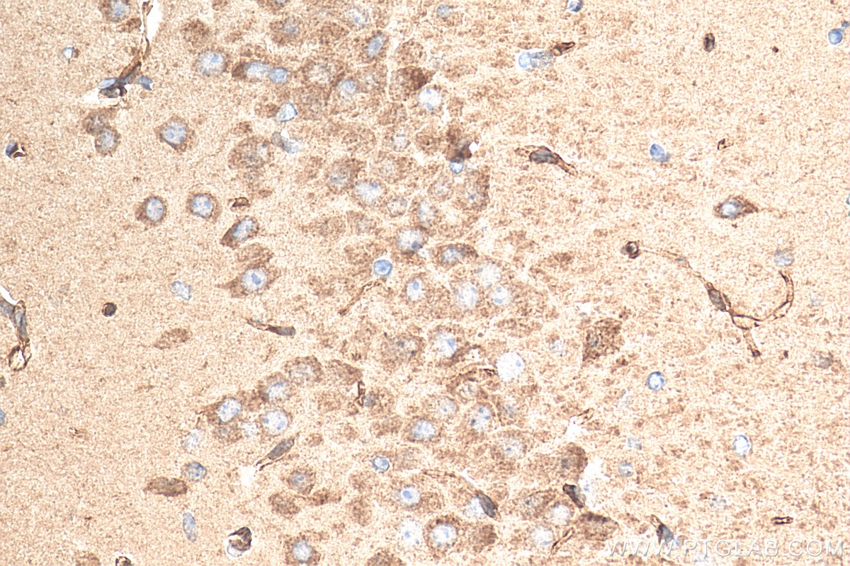 Immunohistochemistry (IHC) staining of mouse brain tissue using LST1 Polyclonal antibody (21361-1-AP)