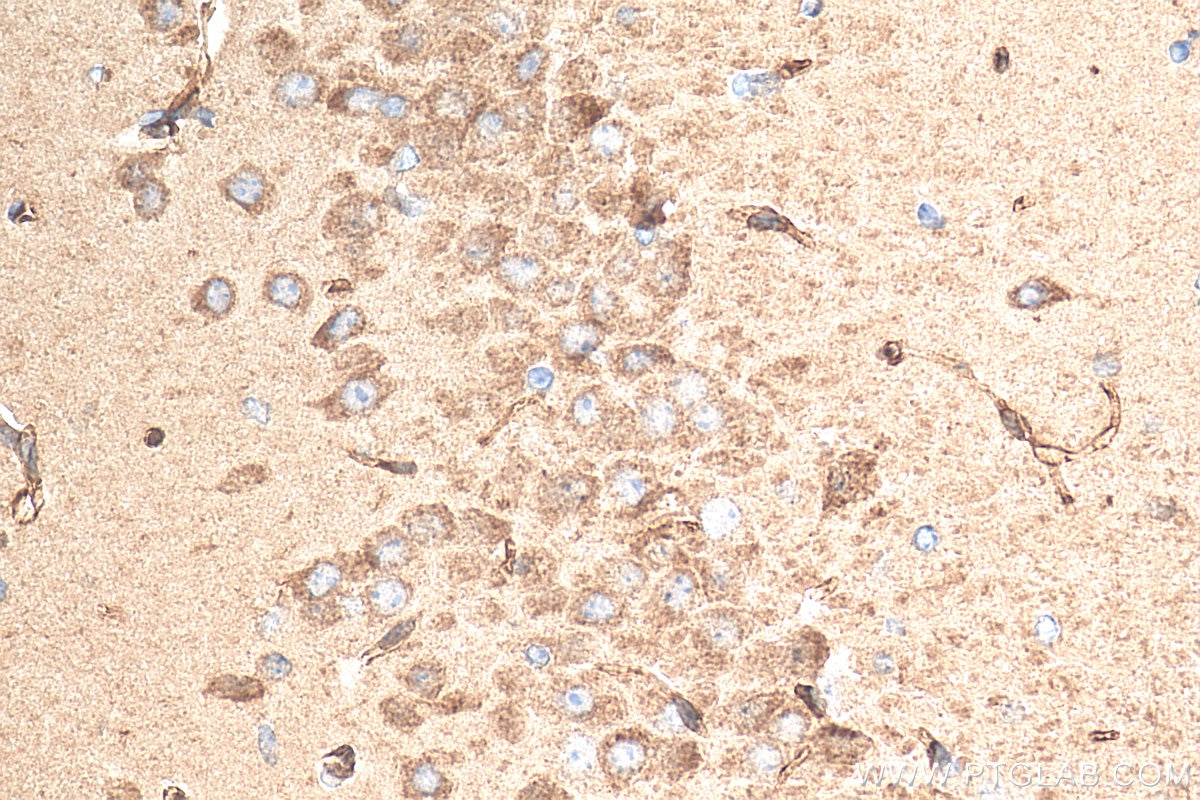 IHC staining of mouse brain using 21361-1-AP