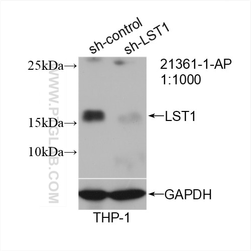Western Blot (WB) analysis of THP-1 cells using LST1 Polyclonal antibody (21361-1-AP)
