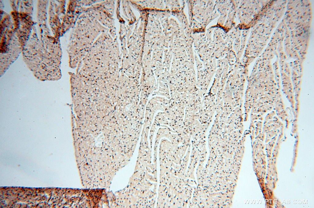 Immunohistochemistry (IHC) staining of human heart tissue using LTA4H Polyclonal antibody (13662-1-AP)
