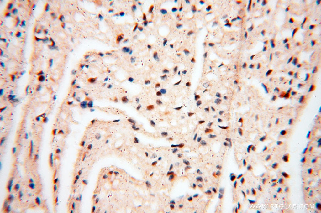 IHC staining of human heart using 13662-1-AP