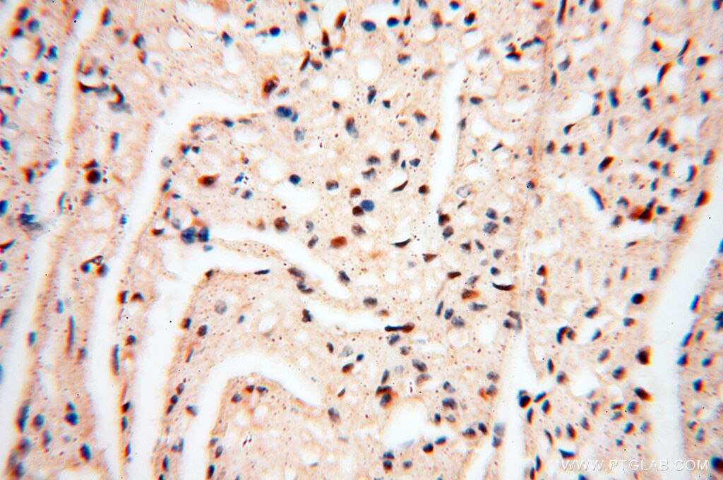 Immunohistochemistry (IHC) staining of human heart tissue using LTA4H Polyclonal antibody (13662-1-AP)