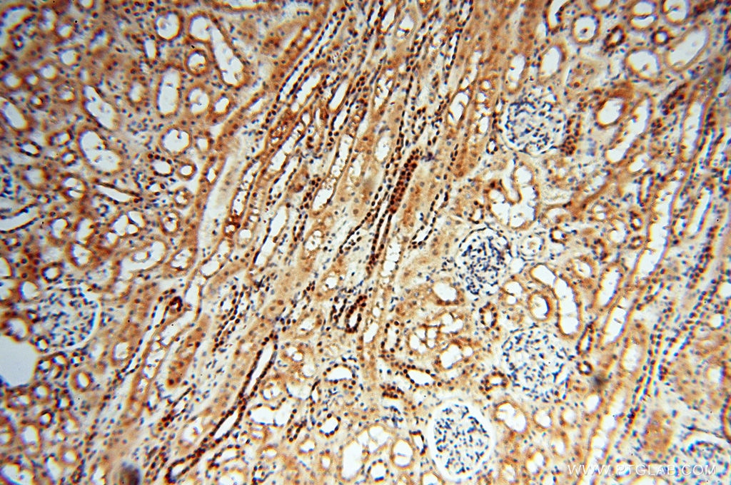 Immunohistochemistry (IHC) staining of human kidney tissue using LTA4H Polyclonal antibody (13662-1-AP)