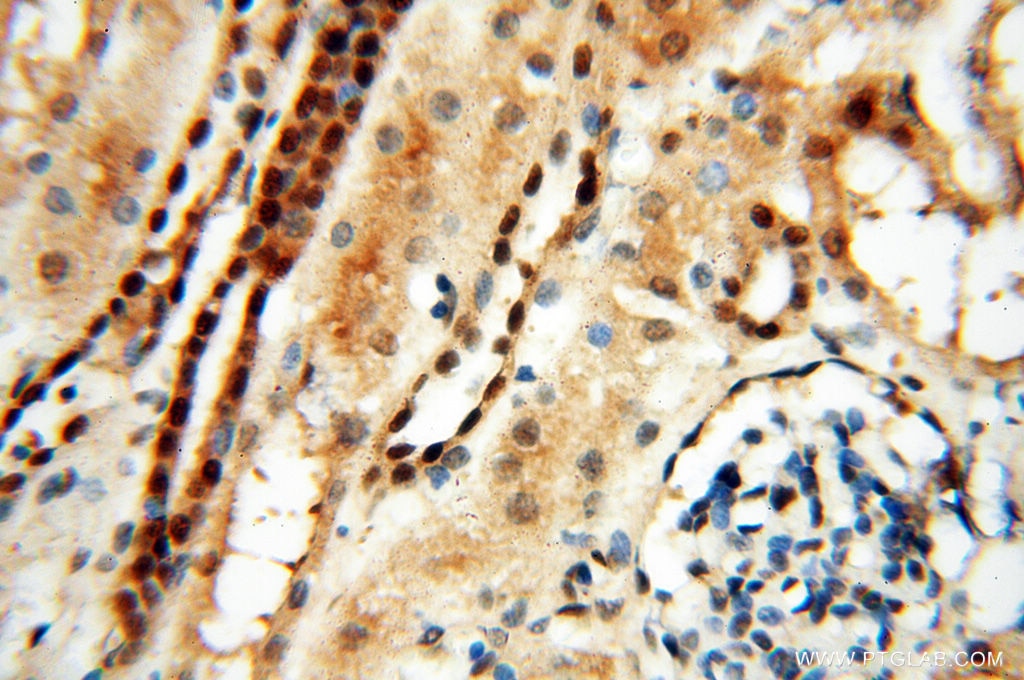 Immunohistochemistry (IHC) staining of human kidney tissue using LTA4H Polyclonal antibody (13662-1-AP)