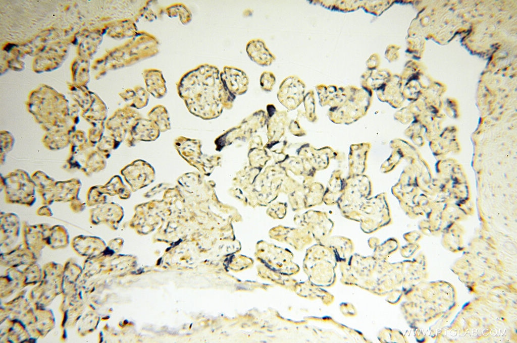 Immunohistochemistry (IHC) staining of human placenta tissue using LTA4H Polyclonal antibody (13662-1-AP)
