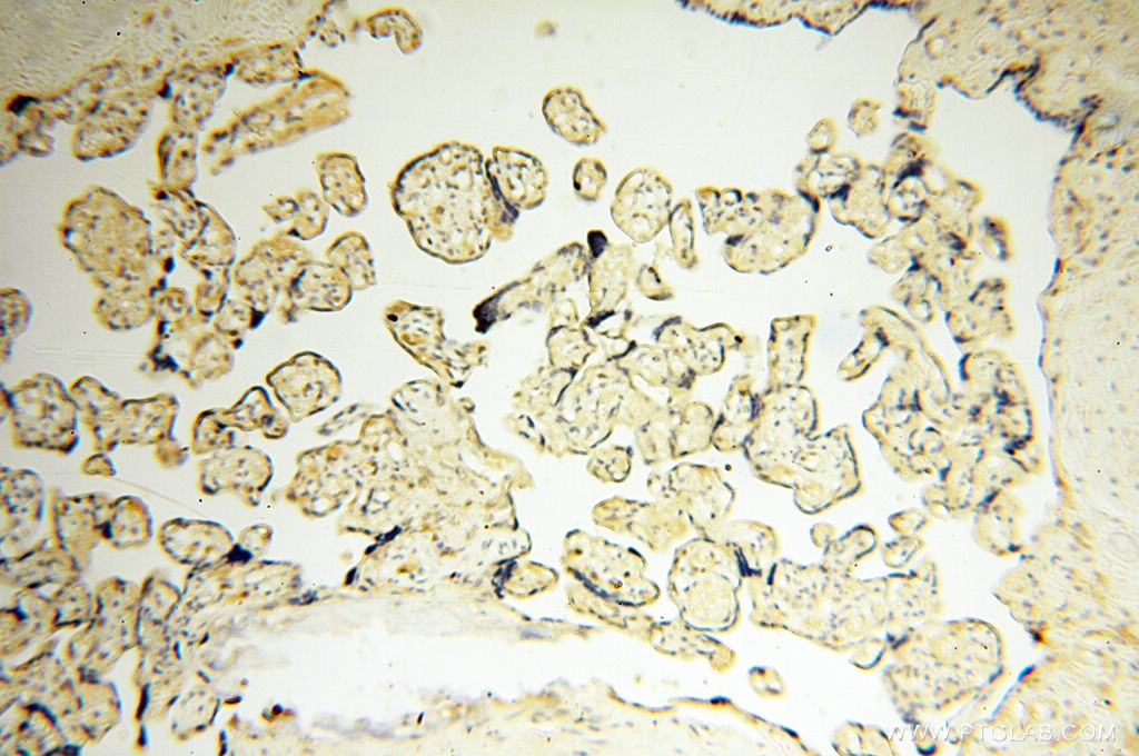 IHC staining of human placenta using 13662-1-AP