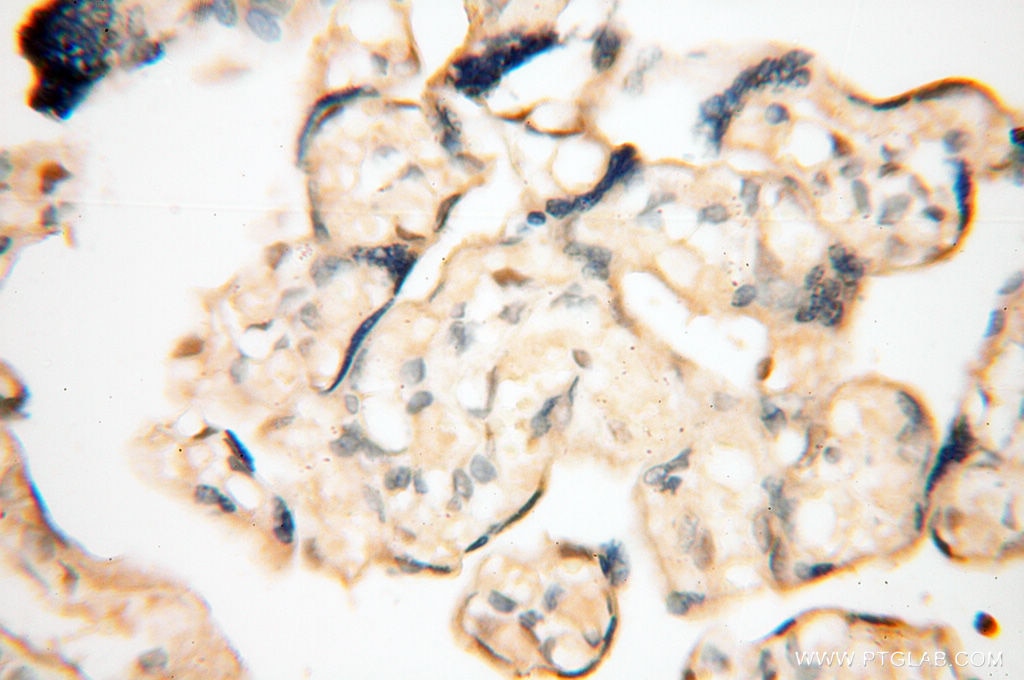 Immunohistochemistry (IHC) staining of human placenta tissue using LTA4H Polyclonal antibody (13662-1-AP)