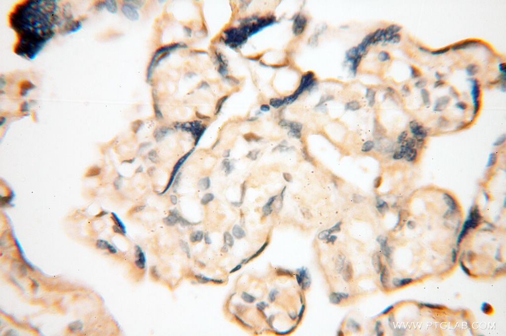 IHC staining of human placenta using 13662-1-AP