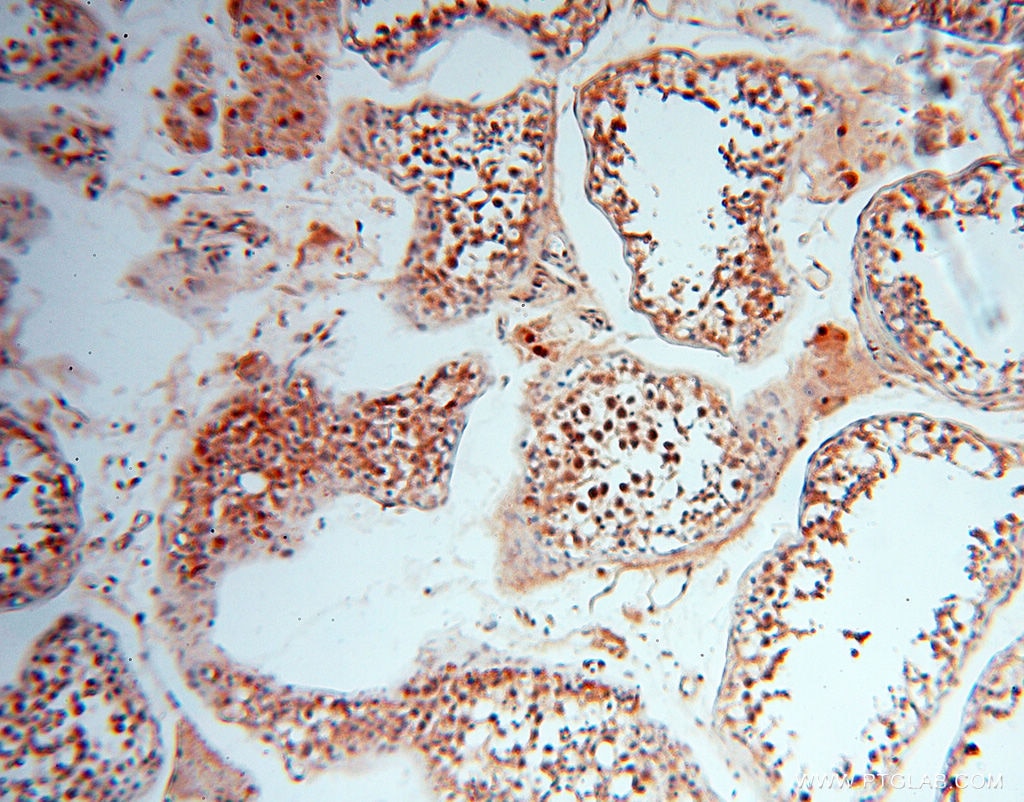 Immunohistochemistry (IHC) staining of human testis tissue using LTA4H Polyclonal antibody (13662-1-AP)