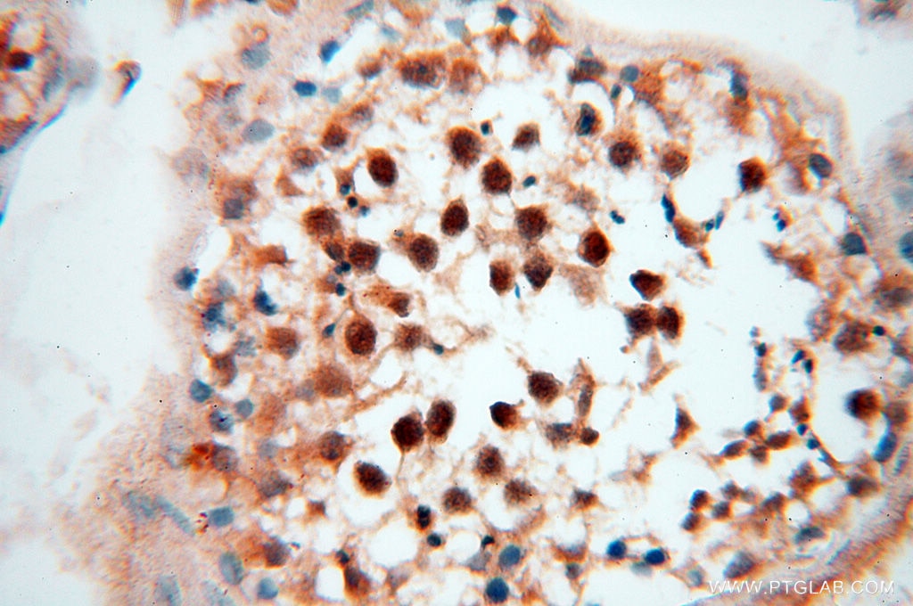 Immunohistochemistry (IHC) staining of human testis tissue using LTA4H Polyclonal antibody (13662-1-AP)