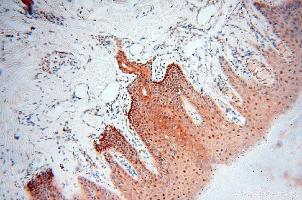 Immunohistochemistry (IHC) staining of human skin tissue using LTA4H Polyclonal antibody (13662-1-AP)