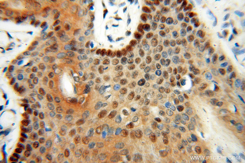 Immunohistochemistry (IHC) staining of human skin tissue using LTA4H Polyclonal antibody (13662-1-AP)