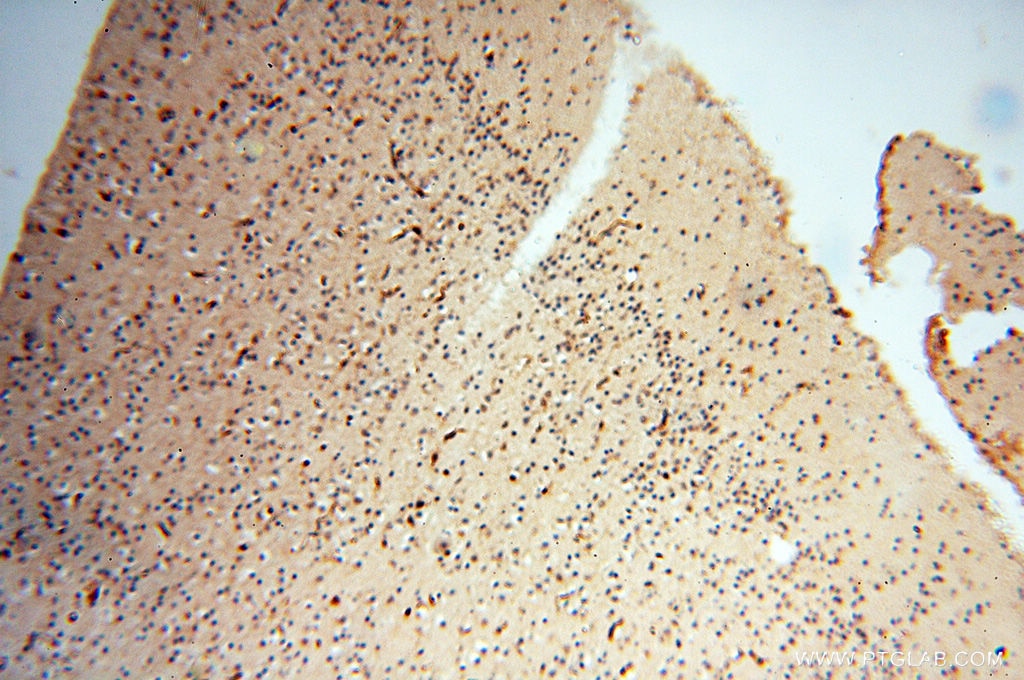 Immunohistochemistry (IHC) staining of human brain tissue using LTA4H Polyclonal antibody (13662-1-AP)