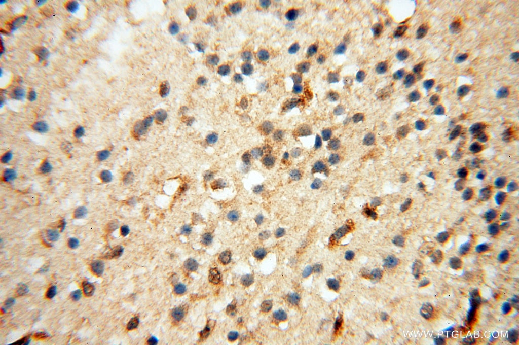 Immunohistochemistry (IHC) staining of human brain tissue using LTA4H Polyclonal antibody (13662-1-AP)
