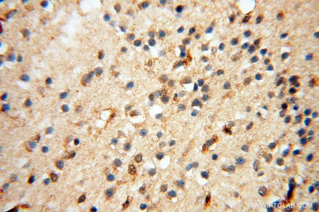 IHC staining of human brain using 13662-1-AP