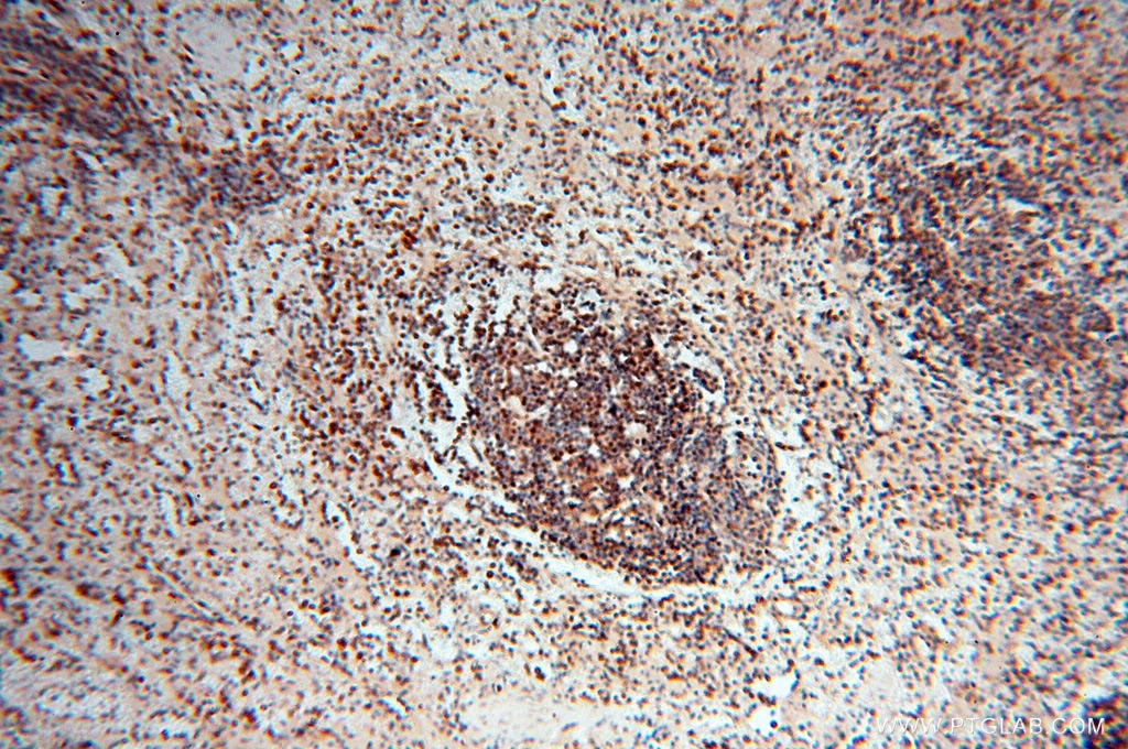 Immunohistochemistry (IHC) staining of human spleen tissue using LTA4H Polyclonal antibody (13662-1-AP)