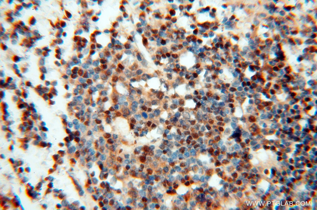 Immunohistochemistry (IHC) staining of human spleen tissue using LTA4H Polyclonal antibody (13662-1-AP)