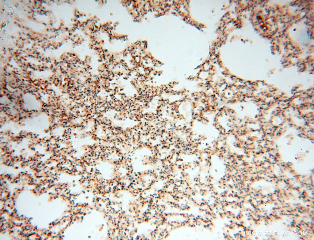 Immunohistochemistry (IHC) staining of human lung tissue using LTA4H Polyclonal antibody (13662-1-AP)