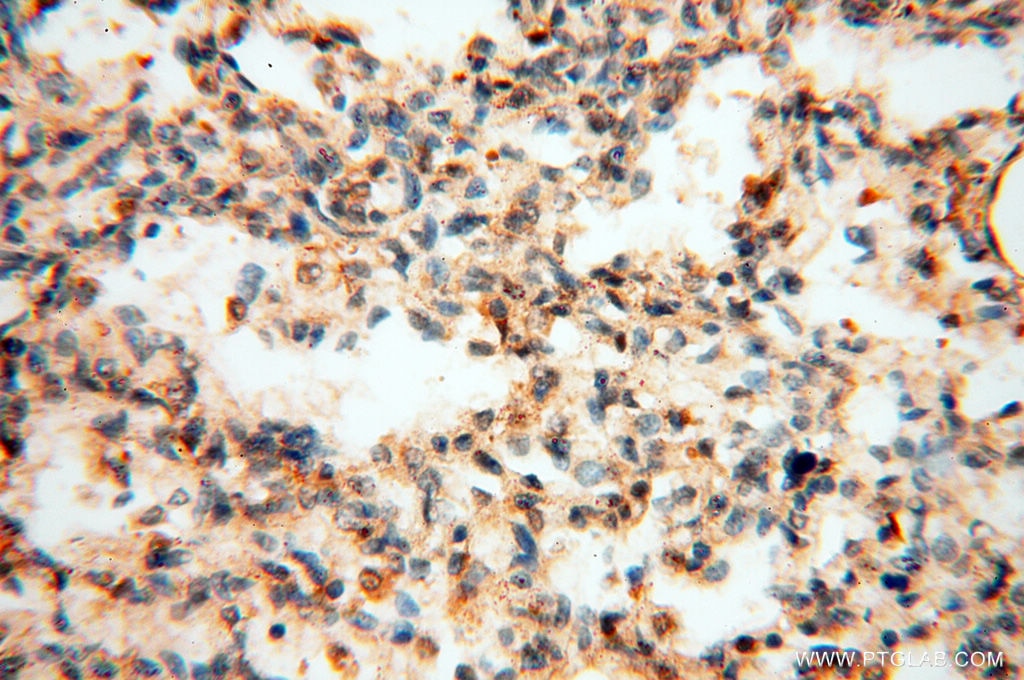 Immunohistochemistry (IHC) staining of human lung tissue using LTA4H Polyclonal antibody (13662-1-AP)