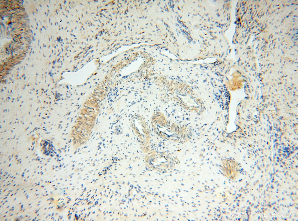 Immunohistochemistry (IHC) staining of human ovary tissue using LTA4H Polyclonal antibody (13662-1-AP)