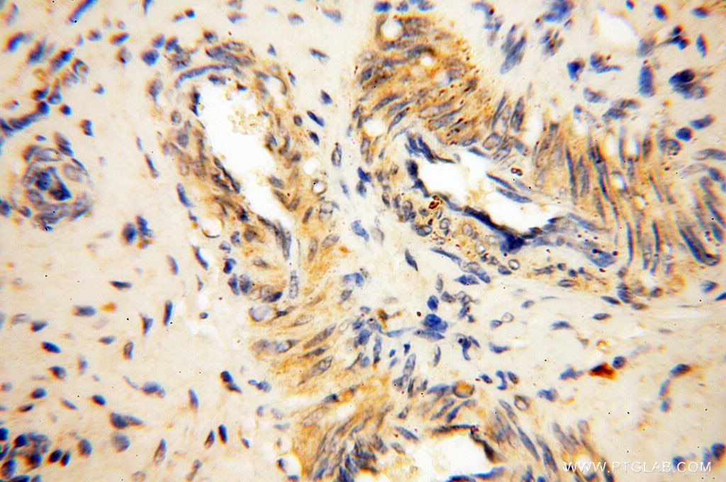 Immunohistochemistry (IHC) staining of human ovary tissue using LTA4H Polyclonal antibody (13662-1-AP)