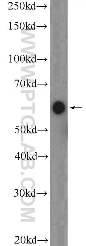 WB analysis of Jurkat using 13662-1-AP